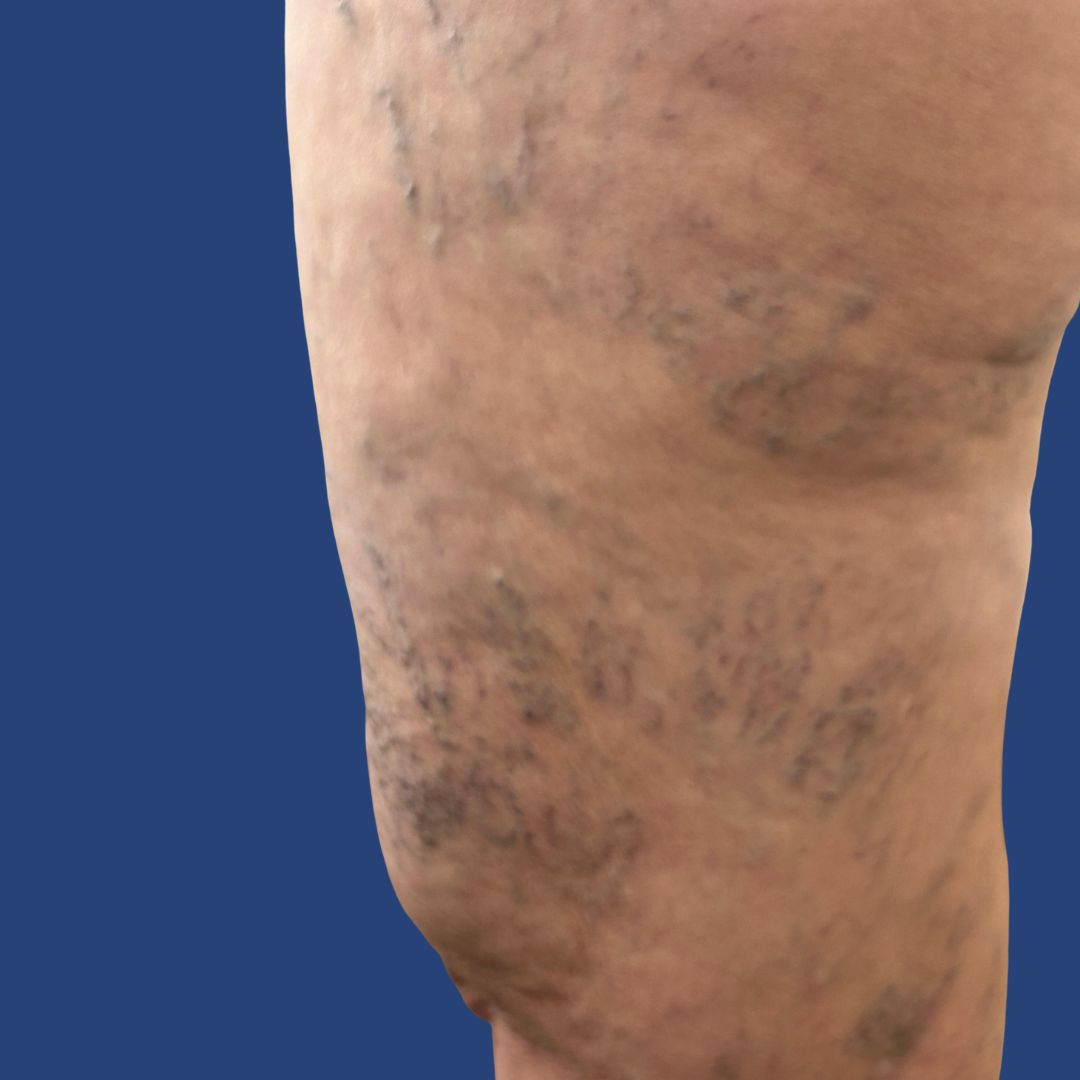 Sem nome (1080 x 400 px) (1080 x 1080 px) (3)