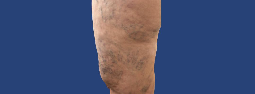 Sem nome (1080 x 400 px) (2)