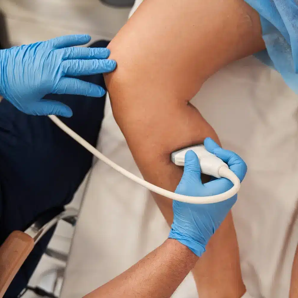 Ecodoppler vascular: o exame que mostra como está sua circulação