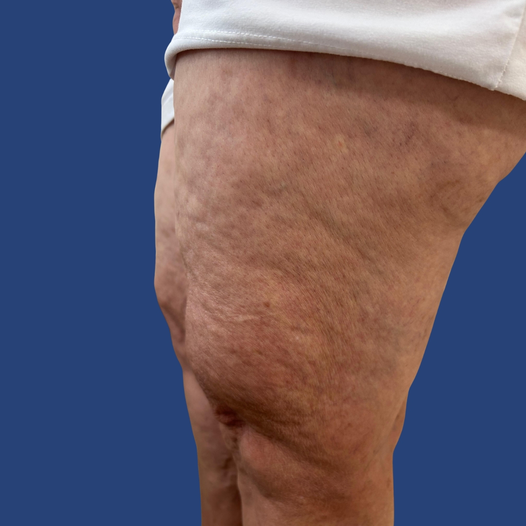 Sem nome (1080 x 400 px) (1080 x 1080 px) (4)