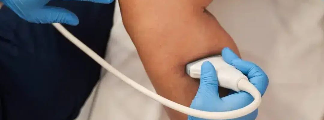 EcoDoppler-vascular (1)